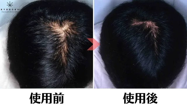 CBDが髪質改善を促すといったエビデンスはない？